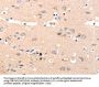 OLR1 Antibody