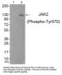 Phospho-JAK2 (Tyr570) Antibody
