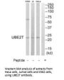 UBE2T Antibody