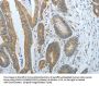 CXCR3 Antibody