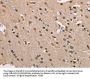 SERPINA1 Antibody