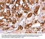 CALB1 Antibody
