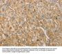 VTN Antibody
