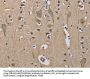 SERPINA1 Antibody