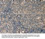 SERPINA1 Antibody