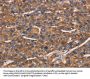 NCSTN Antibody