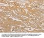 CD40 Antibody