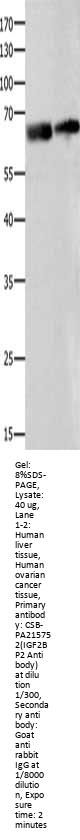 IGF2BP2 Antibody