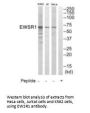 EWSR1 Antibody