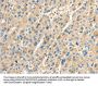 PTGS2 Antibody