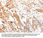 ABCA4 Antibody