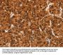BFAR Antibody