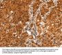 BFAR Antibody