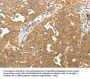 MAP1B Antibody