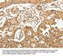 MAP1B Antibody
