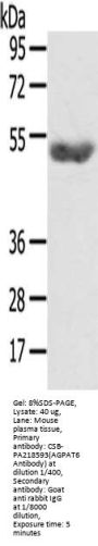 AGPAT6 Antibody