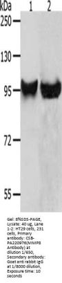 MMP8 Antibody