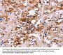 CALB1 Antibody