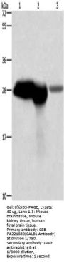 CALB1 Antibody