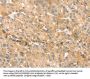 EVA1A Antibody