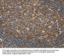 CAMK4 Antibody