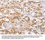 CAMK4 Antibody