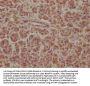 SOS2 Antibody