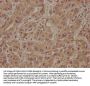 SOS2 Antibody