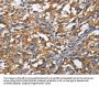 DDR2 Antibody