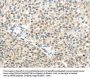 TTBK2 Antibody