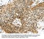 TTBK2 Antibody
