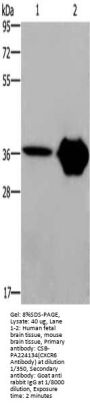 CXCR6 Antibody
