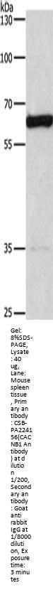 CACNB1 Antibody
