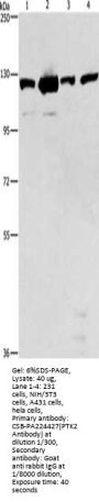 PTK2 Antibody