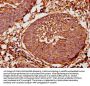 TAP2 Antibody