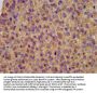KCNE3 Antibody