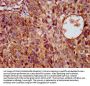 KCNE3 Antibody