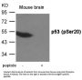 Phospho-TP53 (Ser20) Antibody