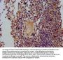 CLC Antibody