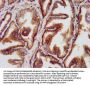 LZTS1 Antibody