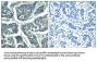 Phospho-PLCG2 (Tyr1217) Antibody