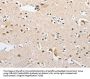 APPBP2 Antibody
