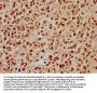 GABPA Antibody