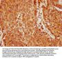 GABPA Antibody