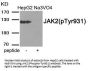 Phospho-JAK2 (Tyr931) Antibody
