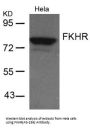FOXO1 (Ab-256) Antibody