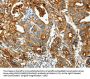 CEACAM5 Antibody
