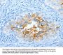 CEACAM5 Antibody