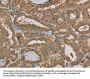 MVK Antibody