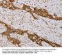 MVK Antibody